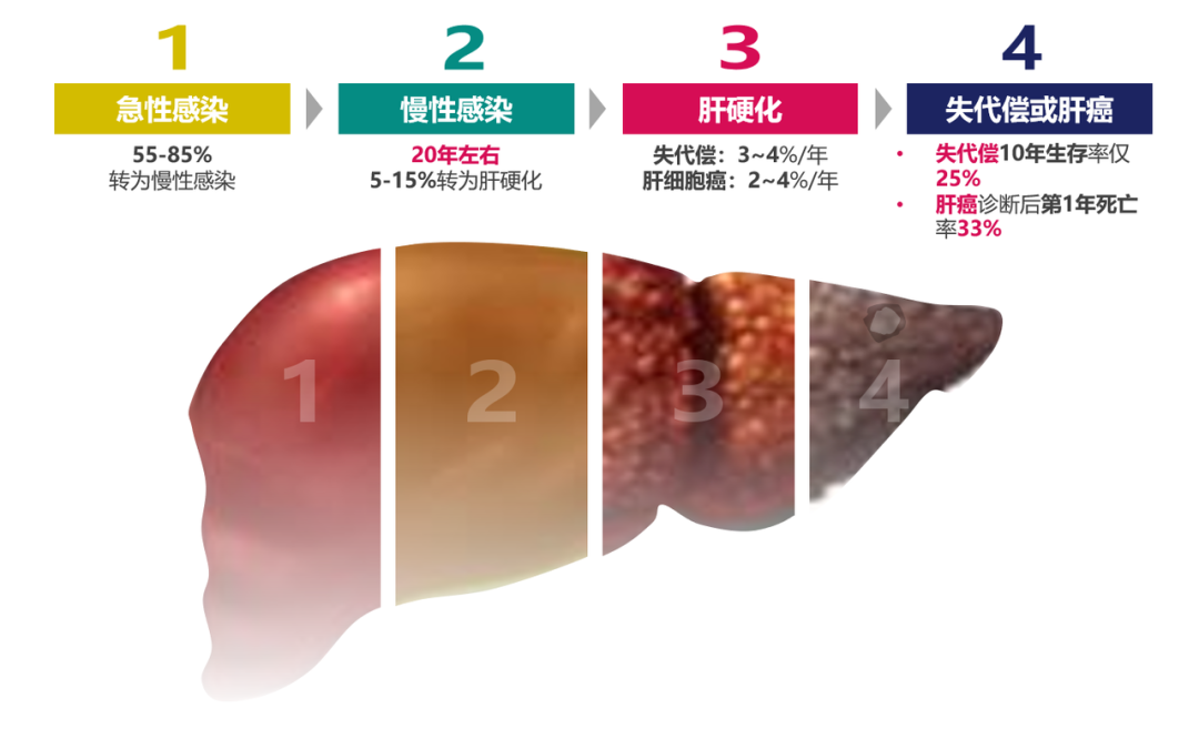 悄悄變成肝硬化、肝癌，很多人感染了卻不知道